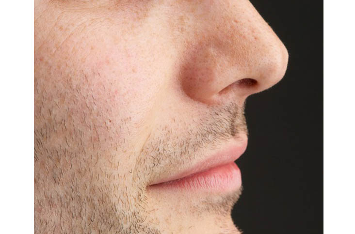 鼻を直す男性の心理は？（写真:iStock）