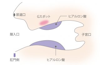 （イートップクリニック提供／無断転載禁止）