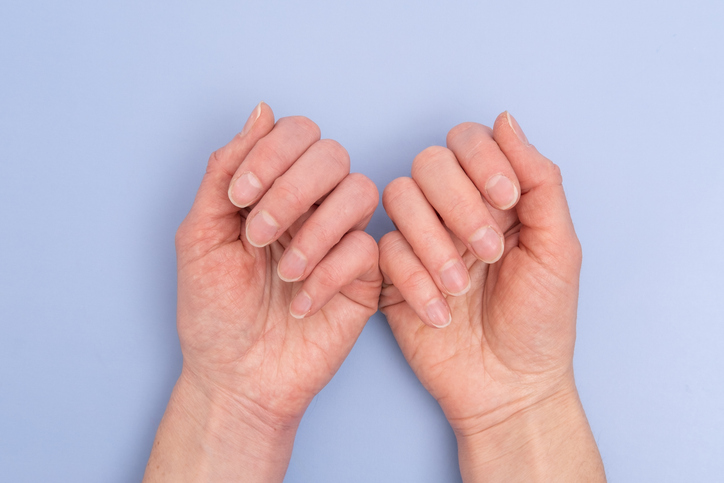 見られていますよ（写真:iStock）