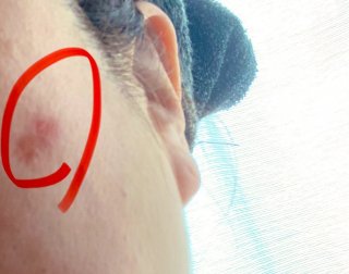 マスク生活で惰性の肌ケア→顔イボ発症！ “老人性”の言葉にショック。こりゃあかん…50代目前で決意したこと