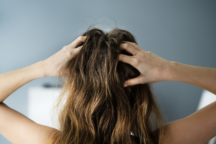 頭皮にも悪影響（写真:iStock）